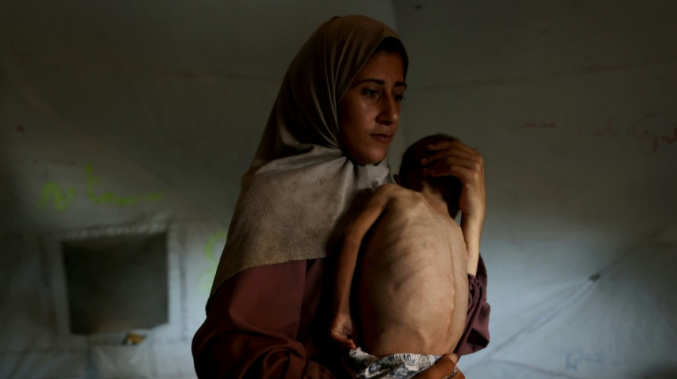 Un cuarto de los ni&ntilde;os peque&ntilde;os de Gaza sufren de malnutrici&oacute;n, afirma MSF