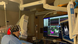 Fibrillazione atriale, ad Ancona eseguito innovativo intervento al cuore