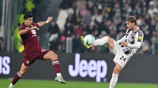 Juve: lesione muscolare per Rugani, torna nel 2026